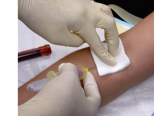 Blood draw Blood draw