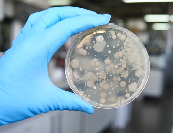 Petri Dish with gloved hand