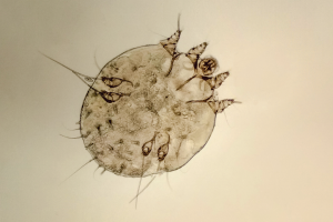 Scabies mite under a microscope
